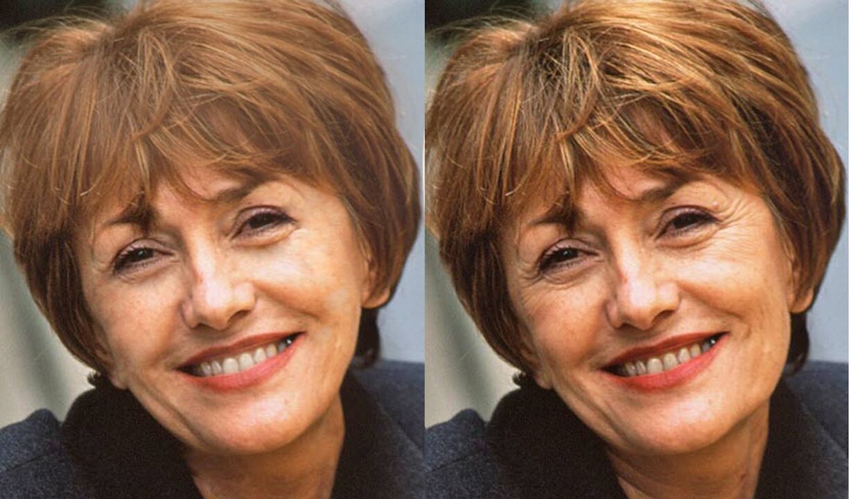 фотографија лица пре и после контурисања